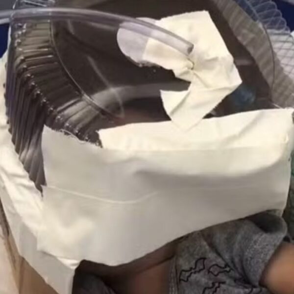 Bebê que usou embalagem de bolo improvisada como máscara de oxigênio tem alta